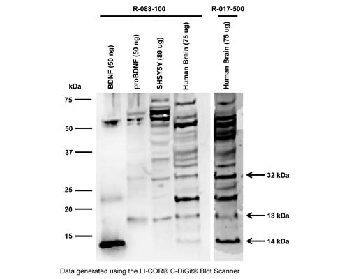 Western blot analysis of BDNF expression in SH-SY5Y cell lysate (RIPA) and human brain. Polyclonal rabbit antibodies to rhBDNF R-088-100 (whole serum, 1:1000) and R-017-500 (IgG, 10 µg/mL) detect monomeric BDNF at 14 kDa in human brain (Tris-homogenate). ProBDNF is detected at the expected molecular weight of 32 kDa for glycosylated proBDNF monomer. A 18 kDa BDNF-isoform is shown that has previously been detected with other BDNF antibodies (Tongiorgi et al., 2012; Silhol et al., 2017). This 18 kDa band is also visible in the proBDNF protein sample, Lane 2.Western Blotting Method: SDS-PAGE: denaturing and reducing, 12% Bis-Tris gel; Transfer: Tris-Glycine buffer, semi-dry transfer; Membrane: nitrocellulose (0.22 µm); Blocking: 5% skim milk in TBST, 1 hour at RT; Primary antibody: overnight at 4°C; Secondary antibody: anti-rabbit-HRP (1/6000), 2 hours at RT; Detection: Chemiluminiscence.