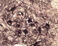IHC on rat spinal cord (free floating cryo section) using Rabbit antibody to recombinant human p75NTR: whole serum (R-089-100) at a dilution of 1: 1000.