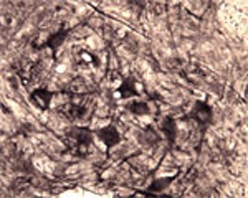 IHC on rat spinal cord (free floating cryo section) using Rabbit antibody to recombinant human p75NTR: whole serum (R-089-100) at a dilution of 1: 1000.