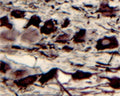 IHC on rat trigeminal nerve (free floating cryo section) using Rabbit antibody to recombinant human p75NTR: whole serum (R-089-100) at a dilution of 1: 1000.