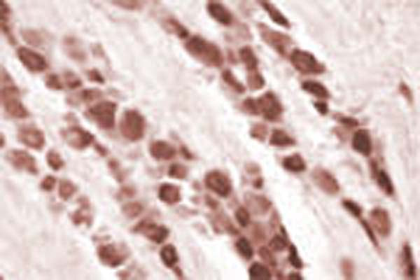 IHC on rat DRG (free floating cryo section) using Rabbit antibody to recombinant rat HAP-1: whole serum (R-090-100) at a dilution of 1: 1000.