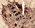 IHC on rat spinal cord (free floating cryo section) using Rabbit antibody to recombinant rat HAP-1: whole serum (R-090-100) at a dilution of 1: 1000. Motor neurons are intensely stained.