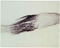 Immunohistochemical staining of Neurotrophin 3 (NT3) in crushed rat peripheral nerve using rabbit antibody to recombinant human NT3, catalogue number R-098-100.