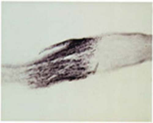 Immunohistochemical staining of Neurotrophin 3 (NT3) in crushed rat peripheral nerve using rabbit antibody to recombinant human NT3, catalogue number R-098-100.