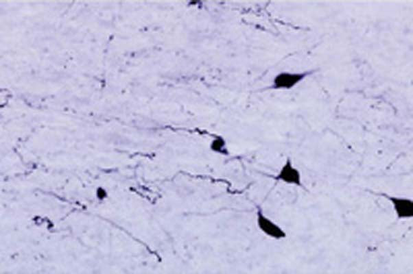 Immunohistochemical staining of orexin A in rat zona incerta neurons using Rabbit antibody to Orexin A (14-33): whole serum, catalogue number R-104-100, at a dilution of 1 in 1000.