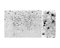 Orexin A-immunoreactive cell bodies and fibers were visualized in floated cryostat sections of the rat lateral hypothalamus. The R-104-100 antibody (1:50 000) was detected with the biotinylated secondary antibody-ABC method and nickel-diaminobenzidine chromogen. Photo courtesy of Dr. Erik Hrabovszky, Hungarian Academy of Sciences, Budapest, Hungary.