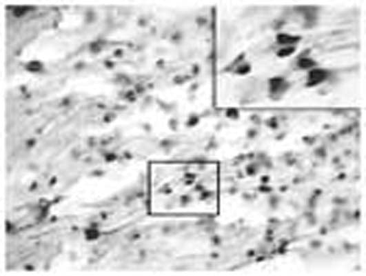 Immunohistochemical detection of contactin-6 in rat sciatic nerve using antisera R-023-50. Anesthetized animals were perfused with 4% paraformaldehyde in PBS containing 12.5% picric acid. Floating cryostat sections of sciatic nerve were permeabilized with 0.5% NP-40 in Tris-buffered saline and blocked with 5% normal goat serum. Sections were incubated with polyclonal rabbit antibody to contactin-6 diluted 1:3000, followed by incubation with biotinylated sheep anti-rabbit antibody and avidin-biotin-peroxidase complex. The immunocomplex was visualized with DAB.