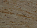 Immunohistochemistry on human brain with brain trauma (car accident), using rabbit antibody to guinea pig degraded myelin basic protein (68-86): whole serum (R-107-100) at a dilution of 1:2000. Courtesy of Dr. Wei-Ping Gai, The Flinders University of South Australia.