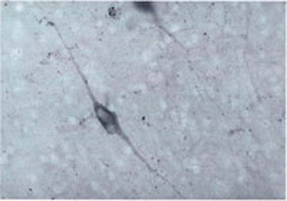Immunohistochemical staining of Dopamine beta-Hydroxylase (DBH) in guinea pig brain stem using rabbit polyclonal to native bovine DBH, catalogue number R-108-100 .