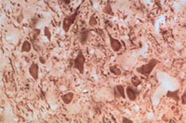 Immunohistochemical staining of parkin in rat brainstem using rabbit polyclonal antibody to human parkin, catalogue number R-113-100. Trigeminal motor neurons are intensely stained.