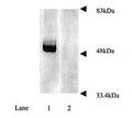 Parkin immunoreactivity: Lane 1, rat brain extract immunoblotted with rabbit polyclonal antibody to human parkin, catalogue number R-113-100; Lane 2, rat brain extract preincubated with the parkin immunogen peptide and immunoblotted with R-113-100.