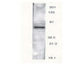 Western blot analysis of rat brain using Rabbit antibody to PTH2 receptor (481-501): whole serum (catalogue no. R-120-100) isolated a major band of 63 kDa corresponding to the theoretical molecular weight of Parathyroid hormone receptor.