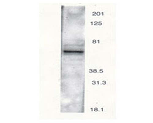 Western blot analysis of rat brain using Rabbit antibody to PTH2 receptor (481-501): whole serum (catalogue no. R-120-100) isolated a major band of 63 kDa corresponding to the theoretical molecular weight of Parathyroid hormone receptor.