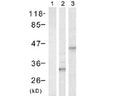 Western Blot analysis of Rabbit polyclonal anti-HIS tag R-1312-100. Lane 1 contains control 293 cells. Lane 2 contains 293 cells transfected with His-tagged S6. Lane 3 contains 293 cells transfected with His-tagged CREB.