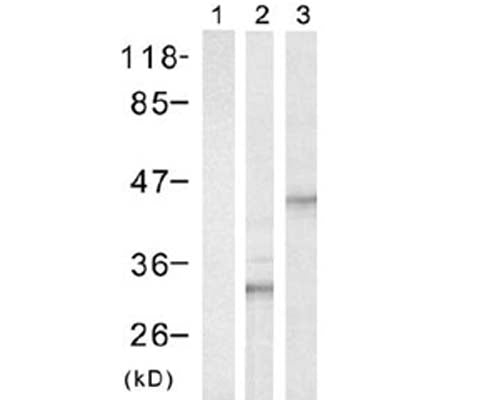 Western Blot analysis of Rabbit polyclonal anti-HIS tag R-1312-100. Lane 1 contains control 293 cells. Lane 2 contains 293 cells transfected with His-tagged S6. Lane 3 contains 293 cells transfected with His-tagged CREB.