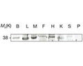 Tissue homogenates from mouse brain (B), liver (L), skeletal muscle (M), fat (F), heart (H), kidney (K), spleen (S) and pancreas (P) were resolved by SDS-PAGE and immunoblotted with Rabbit polyclonal antibody to mouse Adiponectin Receptor 1, catalog number R-1329-100. Image courtesy of Mao et al., (2006) Nature Cell Biology 8:516-523