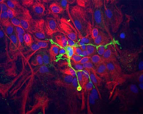 Immunocytochemistry of a mixed neuron/glial culture from newborn rat brain stained with Rabbit polyclonal antibody to Coronin 1a R-1335-50 (green) at a dilution of 1:10,000 and Chicken polyclonal antibody to Vimentin C-1409-50 at 1:5,000. Blue is nuclear DNA counter stain. Glial cells and fibroblasts stain with Vimentin, while microglia alone stain strongly and specifically for Coronin 1a, which can therefore be used as a robust marker of this important cell type.