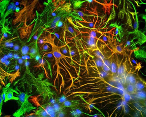 Mixed neuron-glial cultures stained with Rabbit polyclonal antibody to Glial Fibrillary Acidic Protein R-1374-50 (red channel) and Chicken polyclonal antibody to Vimentin C-1409-50 (green channel). The fibroblastic cells contain only Vimentin and so are green, while astrocytes contain either Vimentin and GFAP, so appearing golden, or predominantly GFAP, in which case they appear red. Blue is nuclear DNA stain.