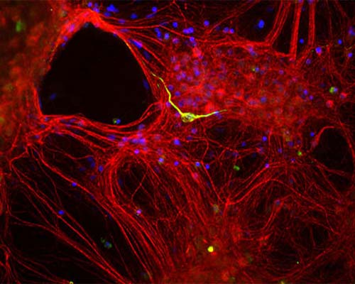 Mixed neuron-glial cultures stained with Rabbit polyclonal antibody to Internexin alpha R-1379-50 (red) and Chicken polyclonal antibody to peripherin C-1399-50 (green). The alpha internexin antibody stains numerous axonal and dendritic profiles in these cultures, while Peripherin antibody binds to only a subset of neurons.