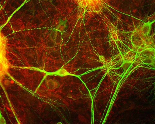 Image of mixed neuron/glial cultures stained with Rabbit polyclonal antibody to Myristoylated alanine rich C kinase substrate (MARCKS) R-1380-50 (red) and Chicken polyclonal antibody to MAP2 C-1382-50. Note that the MARCKS antibody stains vesicular structures both in the glial cells and in the dendrites of the neurons, which are strongly stained with the MAP2 antibody.