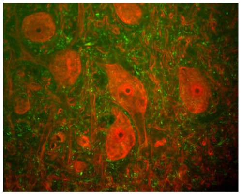 Image of a rat spinal cord section by Immunofluorescence and Immunohistochemistry. The section was stained with R-1388-50, Neurofilament heavy polypeptide, phosphorylated (pNF-H), Rabbit pAb, (green) and co-stained with product M-1407-100, Ubiquitin carboxyl-terminal hydrolase isozyme L1 (UCHL1), Mouse mAb, (red). The neurofilament NF-H antibody binds primarily to phosphorylated axonal forms of NF-H, and so stains axons coursing between the large UCHL1 positive neurons. These large cells are a-motorneurons and UCHL1 protein is a major component of the perikarya and dendrites of these cells.