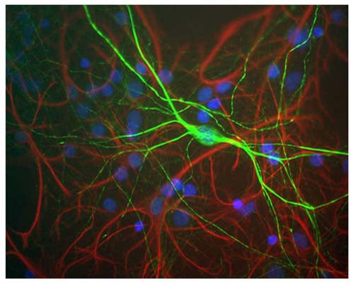Image of mixed neuron and glial cultures stained by Immunofluorescence and Immunocytochemistry. The cultures were stained with R-1389-50, Neurofilament heavy polypeptide, phosphorylated and non-phosphorylated (pNF-H), Rabbit pAb (green), and co-stained with product C-1373-50, Glial Fibrillary Acidic Protein (GFAP), Chicken pAb, (red). The neurofilament NF-H antibody binds to phosphorylated axonal forms of NF-H and non-phosphorylated dendritic and perikaryal forms.