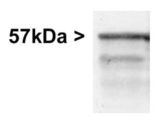Western blot of whole rat brain stem homogenate stained with Rabbit polyclonal antibody to Peripherin R-1401-50 at dilution of 1:20,000. A prominent band running with an apparent SDS-PAGE molecular weight of ~57 kDa corresponds to Peripherin. A lower band at ~48 kDa is derived from the Peripherin molecule.