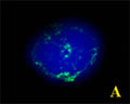A. Confocal microscopy on immunofluorescently detected MPO (in green) in cytospin-isolated human white blood cells counter-stained with Hoechst Dye. Here, the merged picture is presented.