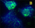 B. Confocal microscopy on immunofluorescently detected MHC class II (in green) in cytospin-isolated human white blood cells. The cells were counter-stained with Hoechst Dye. The merged picture is presented.