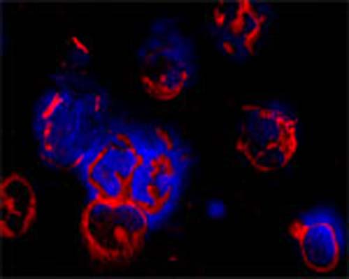Confocal microscopy on immunofluorescently detected ATG10 in cytospin-isolated human white blood cells using Rabbit antibody to ATG10: whole serum (R-145-100) at a dilution of 1: 100, incubated for 1 h at room temperature. The cells stained for ATG10 appear in red. The cells were then counter stained with Hoechst Dye (blue colour). Here, the merged picture is presented. More information on the staining: Fixation: In acetone for 90 seconds. Antibody dilutions: Primary antibody was diluted 1:100 and incubated for 1 hour, washed then 3x, and the secondary (Goat anti Rb 1:100 Alexa 546 conjugate) was incubated for 30 minutes. Magnification 80X.