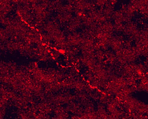 Immunohistochemical staining in rat hypothalamus. 4% paraformaldehyde fixed rat brain crystostat sections (10 µm) were incubated overnight at 4°C with Rabbit polyclonal antibody to Adrenocorticotropic hormone (5 µg/mL) followed by incubation with donkey anti-rabbit Rhodamine Red conjugated secondary antibody (1:200).