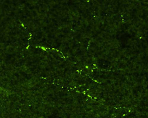 Immunohistochemical staining in rat ventral periaqueductal grey matter (PAG). 4% paraformaldehyde fixed rat brain crystostat sections (10 µm) were incubated overnight at 4°C with Rabbit polyclonal antibody to human beta Endorphin (10 µg/mL) followed by incubation with FITC conjugated secondary antibody.