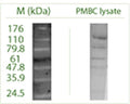 Western blot on Peripheral Blood Mononuclear Cells (PMBC) lysate using Rabbit antibody to ATG4C (APG4C): whole serum (R-156-100) at a dilution of 1: 100 (ECL).