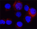 Atg16 L1 detected in cytospun HL60 cells by fluorescence confocal microscopy using antibody R-158-100. HL60 cells were fixed with acetone 90 seconds; primary antibody was diluted 1:100 and incubated for 1 hour, 3 x washes and secondary (Goat anti Rb 1:100 Alexa 546 conjugate) for 30 minutes. Cells stained for Atg16 L1 appear in red. The cells were then counter-stained with Hoechst Dye (blue colour).