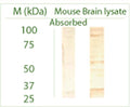 Western blot on mouse brain lysate using Rabbit antibody to ATG3: whole serum (R-159-100) at a dilution of 1: 50. Absorbption with the immunising peptide almost removed the three main bands otherwise visible on the unabsorbed strip.