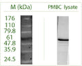 Western blot on Peripheral Blood Mononuclear Cells, non-reduced, (PMBC) lysate using Rabbit antibody to ATG7: whole serum (R-161-100) at a dilution of 1:100 (ECL).