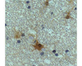 Immunohistochemistry of formaldehyde-fixed human brain, paraffin sections treated with anti-DJ-1 at 1:1000.