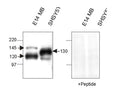 Western Immunoblotting with nicastrin N-terminal domain antibody (Catalog Number R-1686-500) of mouse and human Nicastrin protein in embryonic mouse brain and a human cell line (SHSY5Y). Membrane proteins were prepared and loaded as 20 µg protein per lane. Immunizing peptide absorption removed antibody reactivity.