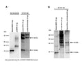 Western blot analysis of BDNF expression in human SH-SY5Y cell lysates (A) and human brain (B). Polyclonal rhBDNF antibody R-1707-100 (1 µg/mL) detects monomeric BDNF at 14 kDa, and monomeric proBDNF at 32 kDa in lysates prepared either in RIPA buffer or in acid-extraction buffer (A). Control antibody M-1744-50/100 (1 µg/mL) confirms detection of mature BDNF (Lane 1) and proBDNF (Lane 2) using BDNF and proBDNF proteins. A second band at 18 kDa is observed in the proBDNF standard, likely to represent a proBDNF degradation product. In human brain (B), R-1707-100 detects mature BDNF (14 kDa) and proBDNF (32 kDa) in both preparations (Tris-buffer and acid-treated). Acid-treated brain demonstrates lower background staining and gives a stronger BDNF signal.Western Blotting Method: SDS-PAGE: denaturing and reducing, 12% Bis-Tris gel; Transfer: Tris-Glycine buffer, semi-dry transfer; Membrane: nitrocellulose (0.22 µm); Blocking: 5% skim milk in TBST, 1 hour at RT; Primary antibody: overnight at 4°C; Secondary antibody: anti-mouse-HRP or anti-rabbit-HRP (1/6000), 2 hours at RT; Detection: Chemiluminiscence.