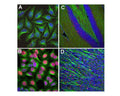 Analysis of c-Fos expression in cultured HeLa cells by Immunocytochemistry (A-B), and in mouse hippocampus (C) or olfactory bulb sections (D) by Immunohistochemistry. HeLa cells were kept in serum-free medium for 36 hours, before cells were stimulated with 20% FBS for 30 minutes (B), while control cells (A) were treated with PBS as a control. The rabbit anti-c-Fos antibody (red, 1:5,000) labels nuclei of stimulated cells, while DAPI (blue) stains all cell nuclei independent of their activity stage. Green: mouse anti-tubulin antibody. Mouse hippocampus (C) and olfactory bulb sections (D) were stained with rabbit anti-c-Fos antibody (red, 1:20,000) and mouse antibody to NF-L (green). The c-FOS antibody stains only nuclei of spontaneously active neurons. NF-L is expressed in axons of neuronal cells. Blue: Cell nuclei stained with DAPI. IHC Method: Following transcardial perfusion of mouse with 4% paraformaldehyde, brain was post fixed for 24 hours, cut to 45 uM, and free-floating sections were stained with above antibodies.