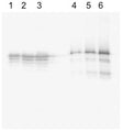 Western blot analysis on recombinant human Tau purified from E.Coli (lanes 1-3; 10, 20 and 40 µg respectively) and on porcine brain lysate (lanes 4-6; 20, 40, 80 ng respectively) under reducing conditions using Rabbit antibody to human Microtubule-associate protein Tau: whole serum (R-184-100) at a dilution of 1: 500. This antibody detected recombinant human Tau with the smaller fragments likely representing degradation products from the purified protein, which has been expressed in E. Coli. In the porcine cytosol, this antibody detected several bands that represents the different Tau isoforms and likely phosphorylated species. This polyclonal antibody is independent of phosphorylation.