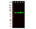 Analysis by western blot of NF-L expression in different rat and mouse tissue homogenates with R-2113-50, Neurofilament light polypeptide, C-terminus, (NF-L-Ct), Rabbit pAb, (green, 1:20,000) with strong banding at 68-70kDa corresponding to the NF-L protein. Lane 1: molecular weight marker; Lane 2: rat brain; Lane 3: rat spinal cord; Lane 4: mouse brain; Lane 5: mouse spinal cord.