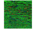Image of a rat spinal cord section with a three-day-old midline C4 contusion injury by Immunofluorescence and Immunohistochemistry. The section was stained with R-2124-100, Neurofilament light polypeptide (NF-L) DG-Sensor™, Rabbit pAb, (red, 1:1,000) and co-stained with product M-1394-100, Neurofilament medium polypeptide (NF-M), Clone 3H11, Mouse mAb, (green, 1:1000). Product R-2124-100 does not stain the undamaged axons that M-1394-100 strongly stains (green). Linear arrays of swollen profiles originating from damaged axons, on the other hand, are strongly positive for R-2124-100, but not for the M-1394-100. In these regions, the M-1394-100 epitope, which is located in the C-terminal "tail" of NF-M, has been either removed or destroyed.