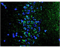 Fluoro-Jade C (FJC) staining (green) of degenerating neurons in the CA3 region of the hippocampus in old diabetic rats. Blue: DAPI nuclear stain. Picture courtesy of Dr. Wang and colleagues. Results of this study were published in Wang S. et al. (2020), Geroscience, PMID: 32696219.