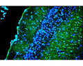 Double exposure using combined blue and ultraviolet epi-fluorescent illumination of the superficial layers of the cingulated rat cortex exposed to kainic acid. Layer I contains conspicuous Fluoro-Jade C positive degenerating axon terminals. Layer II contains densely packed DAPI-positive viable granule cells. Layer III contains a mixture of Fluoro-Jade C positive denegerating pyramidal cells and DAPI-positive viable pyramidal cells. Photo is courtesy of Dr. Larry Schmued.