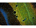 Double exposure using combined blue and ultraviolet epi-fluorescent illumination of the superficial layers of the cingulated rat cortex exposed to kainic acid. Layer I contains conspicuous Fluoro-Jade C positive degenerating axon terminals. Layer II contains densely packed DAPI-positive viable granule cells. Layer III contains a mixture of Fluoro-Jade C positive denegerating pyramidal cells and DAPI-positive viable pyramidal cells. Photo is courtesy of Dr. Larry Schmued.