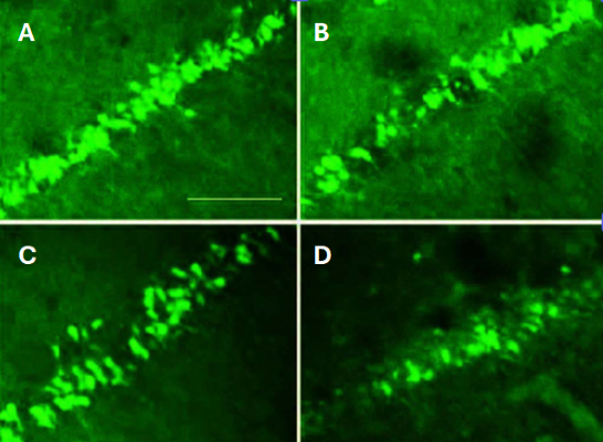 FJB staining of pilocarpine-treated rat hippocamal CA1 region. Positive cells were abundant in the CA1 of saline-treated SE rats after pilocarpine treatment (A). There were significantly fewer FJB-positive cells in the CA1 as the dose of a protective drug was increased (B, C, D) compared to saline-treated SE rats. Picture courtesy of Gao F et al. (2014), Neuropsychiatr Dis Treat. 10: 2139-2145.