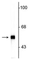 Western blot of rat cerebellar lysate showing specific immunolabeling of the ~57 kDa peripherin protein.