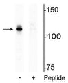 Western blot of HeLa lysate showing specific immunolabeling of the ~110 kDa AR protein phosphorylated at Ser94 in the first lane (-). Phosphospecificity is shown in the second lane (+) where the immunolabeling is blocked by the phosphopeptide used as antigen but not by the corresponding non-phosphopeptide (not shown).