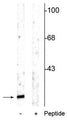 Western blot of rat cortical lysate showing specific immunolabeling of the ~15 kDa alpha synuclein protein phosphorylated at Ser129 in the first lane (-). Phosphospecificity is shown in the second lane (+) where the immunolabeling is blocked by the phosphopeptide used as antigen but not by the corresponding non-phosphopeptide (not shown).